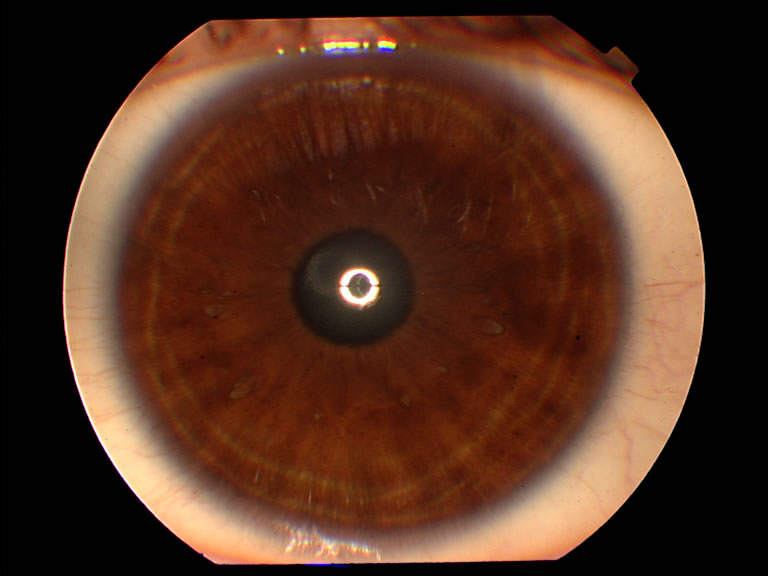 Segmentasi Dan Ekstraksi Citra Iris Mata Dengan Hard K Means Sirami Ilmu Dalam Diri Kita Dengan Membaca